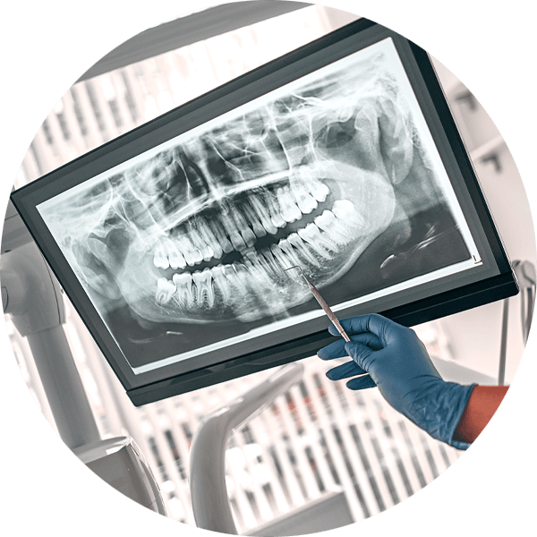 The Importance Of Regular Dental X-Rays
